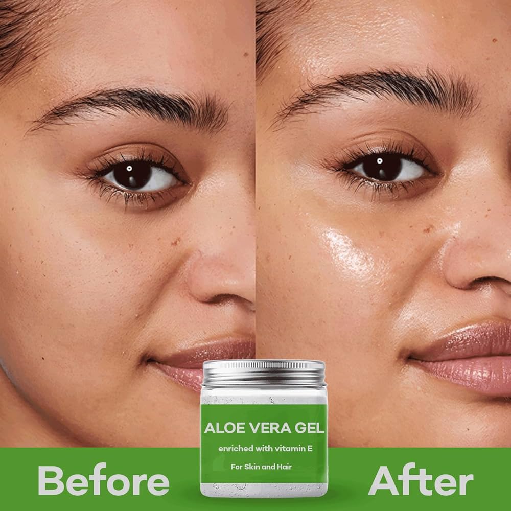 Before and after results of using aloe vera gel on skin.