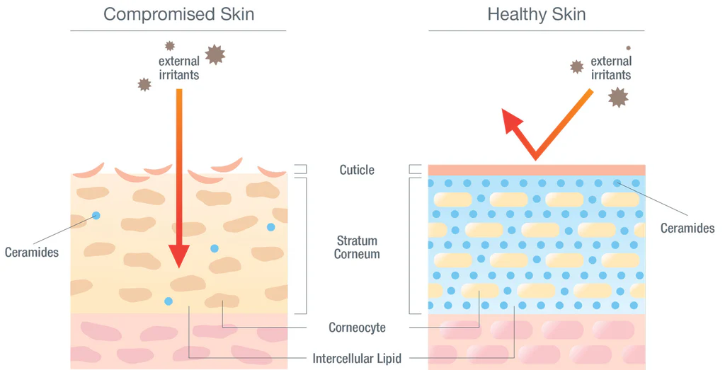 Comparison odf compromised vs. healthy skin showing barrier function against external irritants.