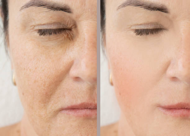 Before and after images showing improvement in skin damage with reduced redness and spots.